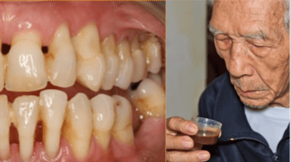Tento stařík si úplně vyléčil paradentózu. Dnes svůj recept sdílí se světem