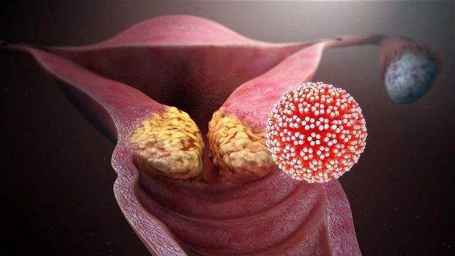 hpv_virus_jobb