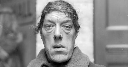 safe_image