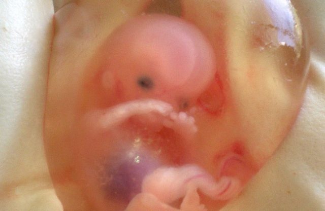abortirani-fetusi-1-646x420