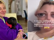 Anička Slováčková je v nemocnici. Ruší pracovní plány Anička Slováčková foto: instagram.com
