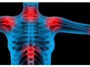 FIBROMYALGIE, PŘÍZNAK, KTERÝ SE OBJEVUJE V NOCI: VĚNUJTE POZORNOST TOMU!