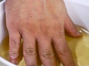 Naučte se, jak pomocí jablečného octa navždy odstranit bolesti a záněty svalů a kloubů!