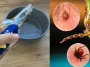 Osvědčené babské triky proti klíšťatům: Potřete si tímto Kotník a škůdci se k vám ani nepřiblíží!