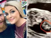 žena se modlila za plod s vážnými vadami. Vyléčilo se jí v bříšku!