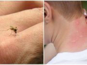 Jak se můžete přes noc zbavit všech komárů? Zkuste tohle! Stačí pár korun a trocha času